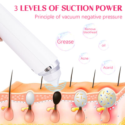 Vacuum Blackhead Remover Visible Facial Pore Cleanser HD Camera Suction Tool